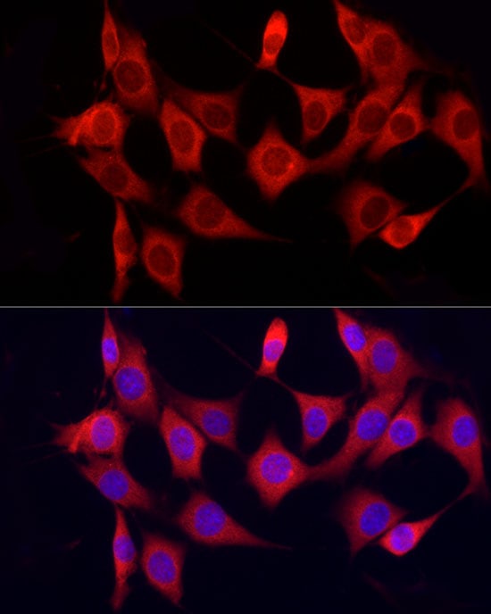 CYP7B1 Antibody