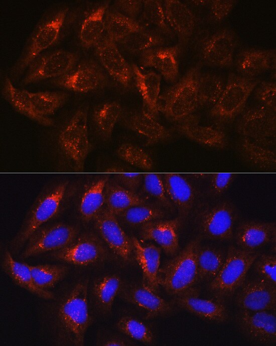HGS Antibody
