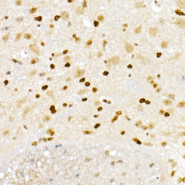 XRCC2 Antibody