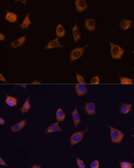 PHLPP2 Antibody