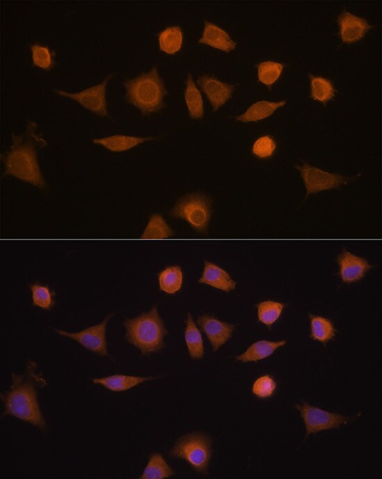 GSTA1 Antibody