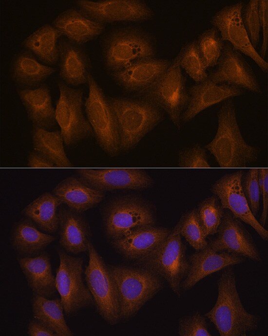 GSTA1 Antibody