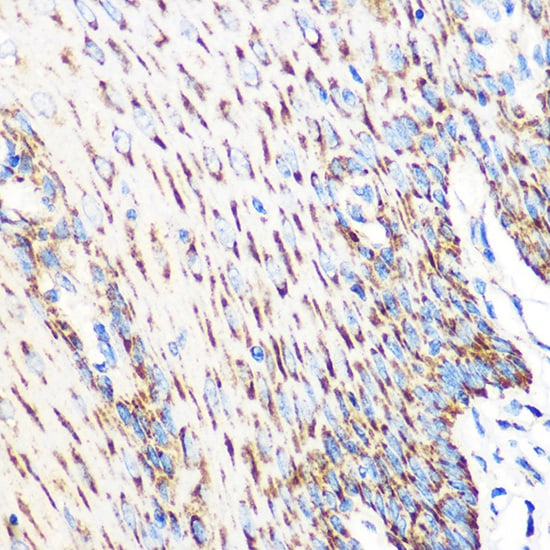 OSR1 Antibody