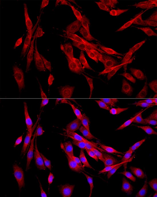 MEIS1 Antibody