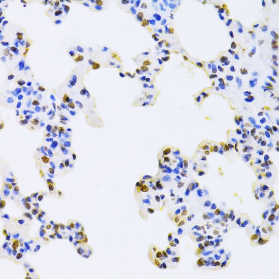 AUF1 Antibody