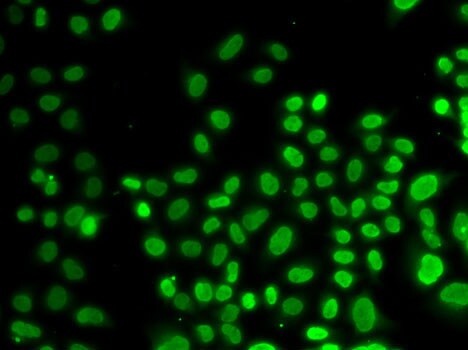 AUF1 Antibody