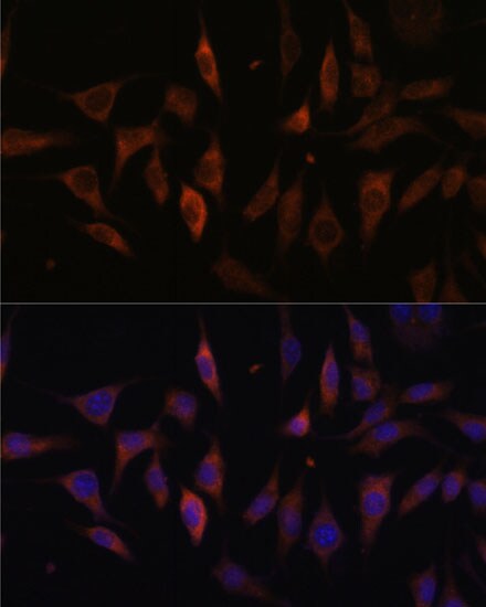 MT-ND1 Antibody