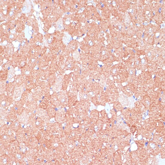 ARHGAP4 Antibody