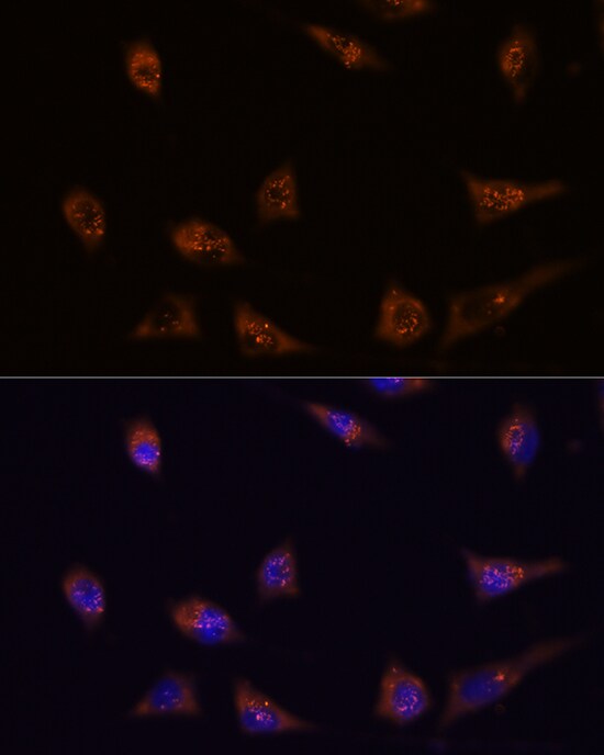 DIP2C Antibody
