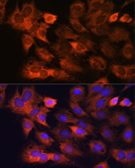 RPS8 Antibody