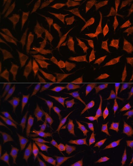 RPS8 Antibody
