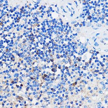 GPR109B/HM74 Antibody