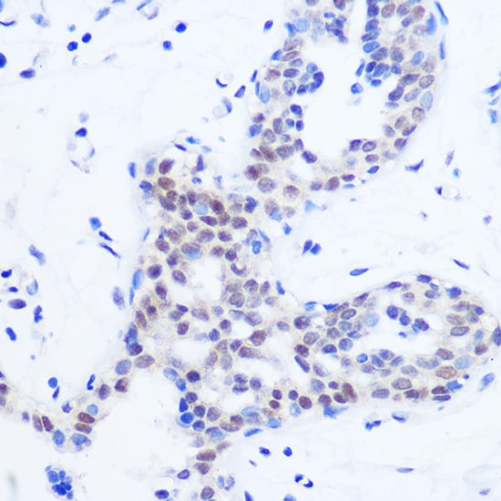 Splicing factor, arginine/serine-rich 11 Antibody