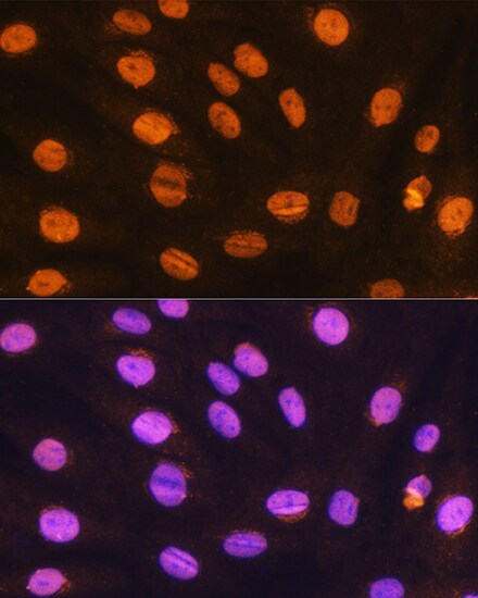gtf3c3 Antibody
