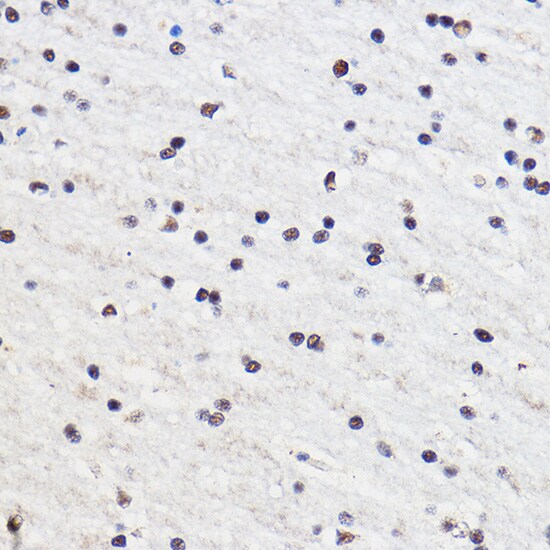 gtf3c3 Antibody