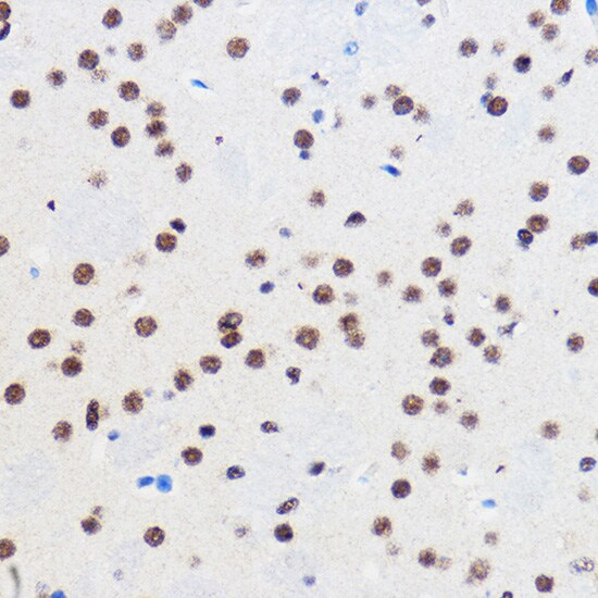 gtf3c3 Antibody