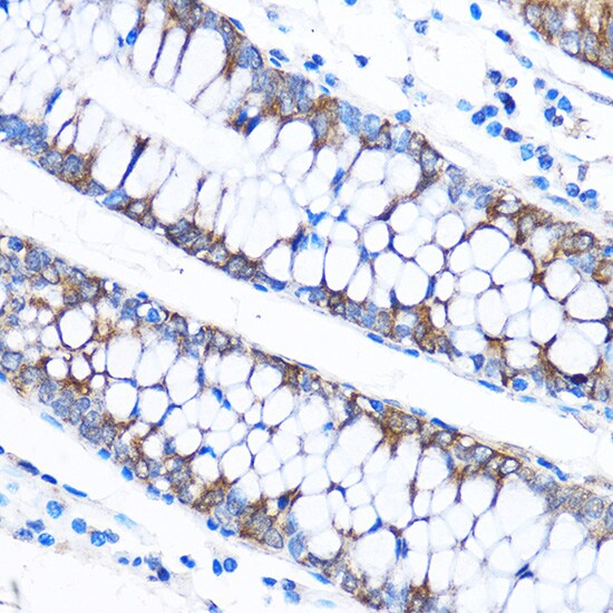 CABP1 Antibody