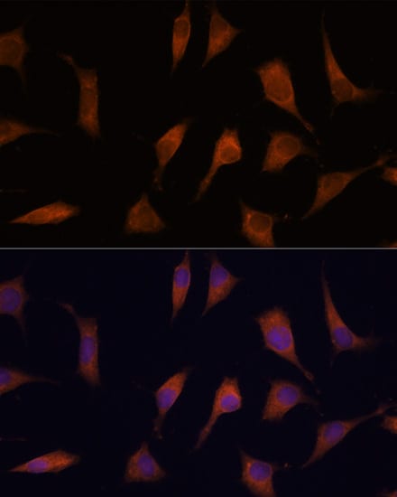 CNAP1 Antibody