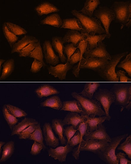 CNAP1 Antibody