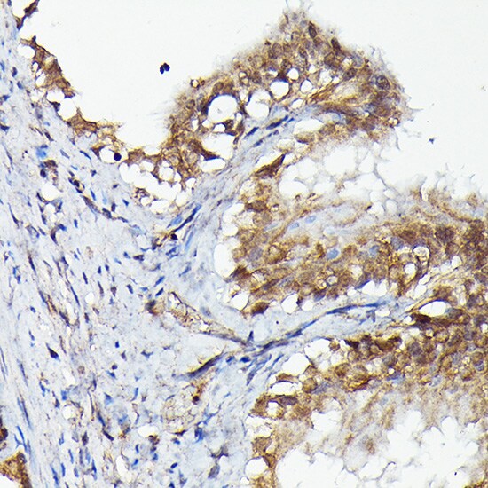 MNK1 Antibody