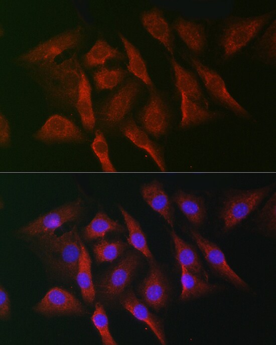 MNK1 Antibody