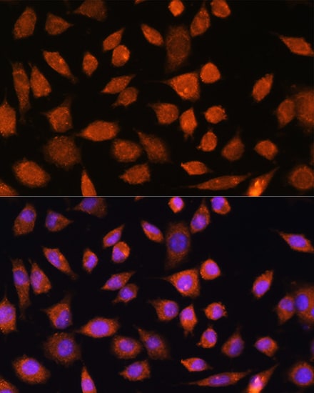 PLD3/Phospholipase D3 Antibody