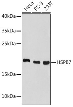 HspB7 Antibody