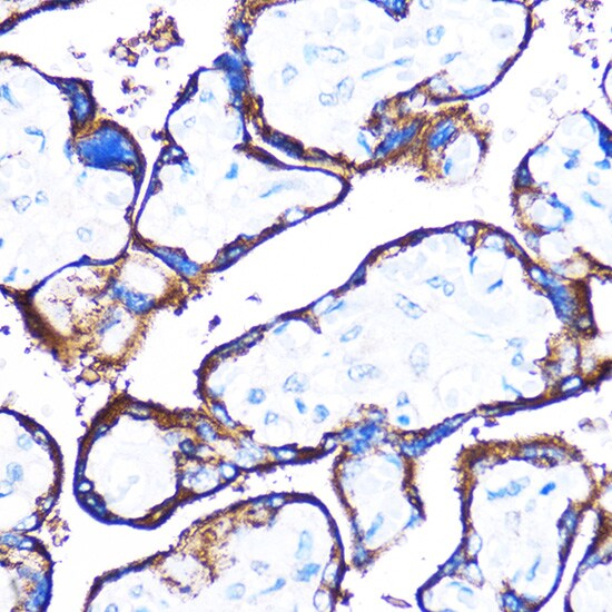 HspB7 Antibody