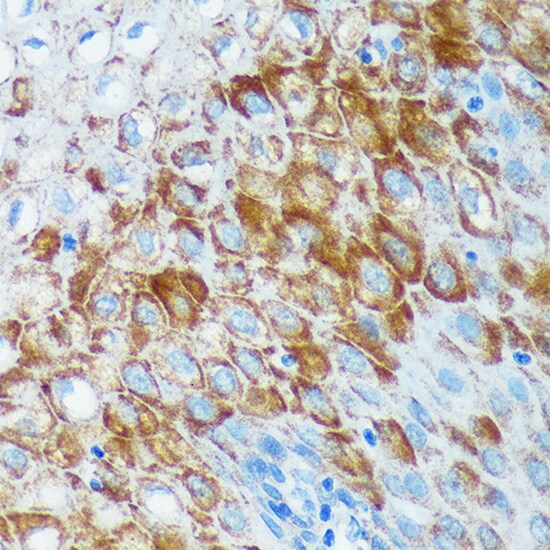 IER5 Antibody