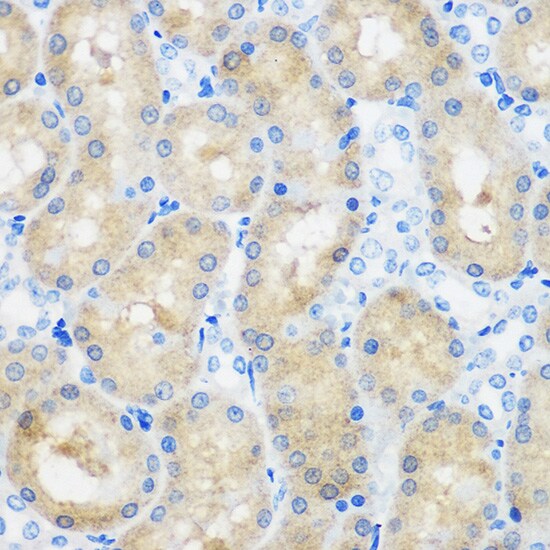 SPOUT1 Antibody