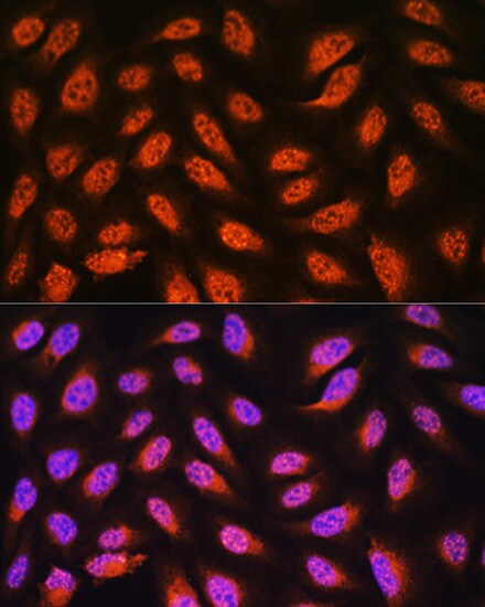 PNPO Antibody
