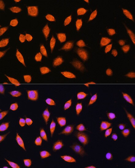 PNPO Antibody