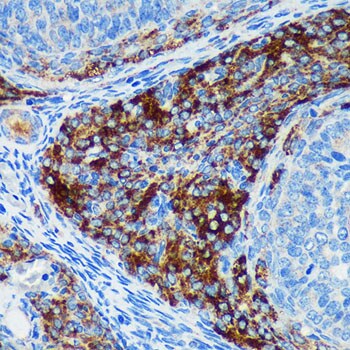 PIGU Antibody