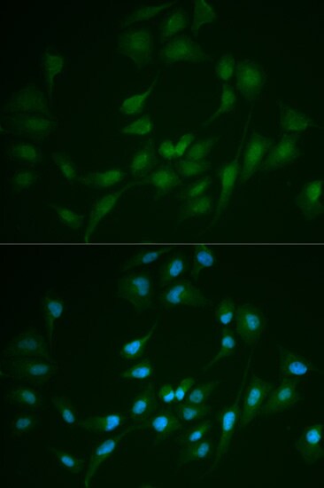 DNA Ligase I Antibody