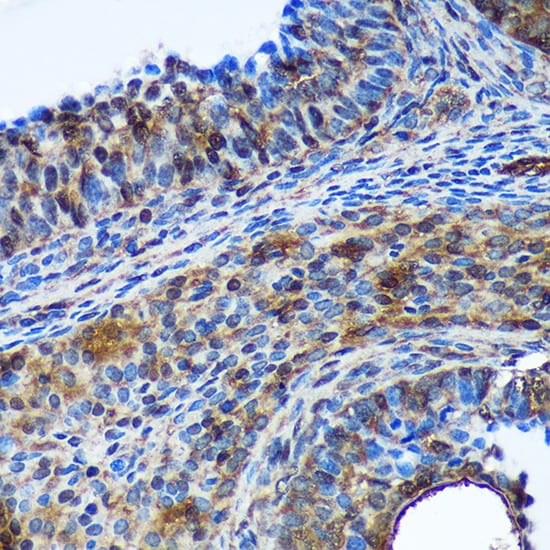 Translin Antibody