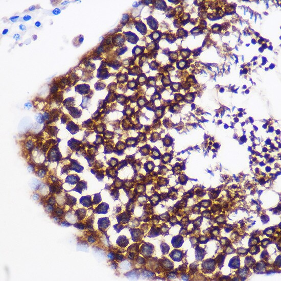 Prostaglandin E Synthase Antibody