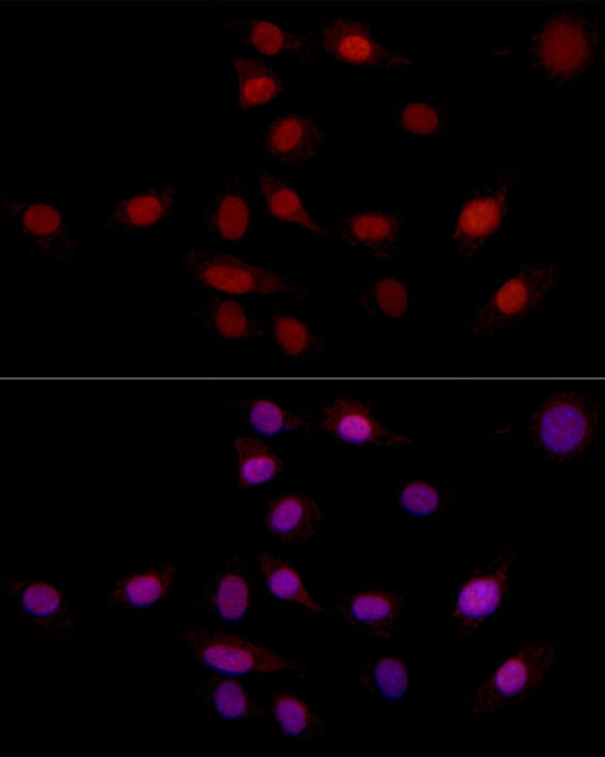 SUPT16H Antibody