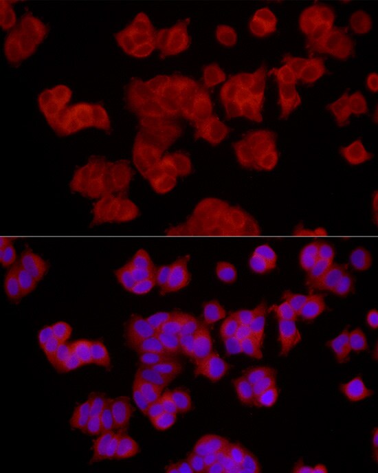 EPHX2 Antibody