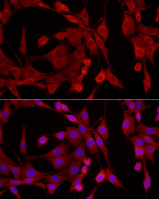EPHX2 Antibody
