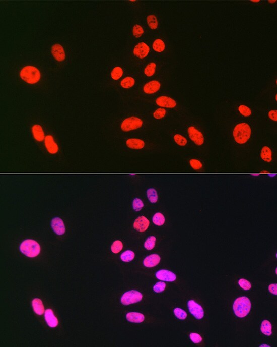 hnRNP C1 + C2 Antibody