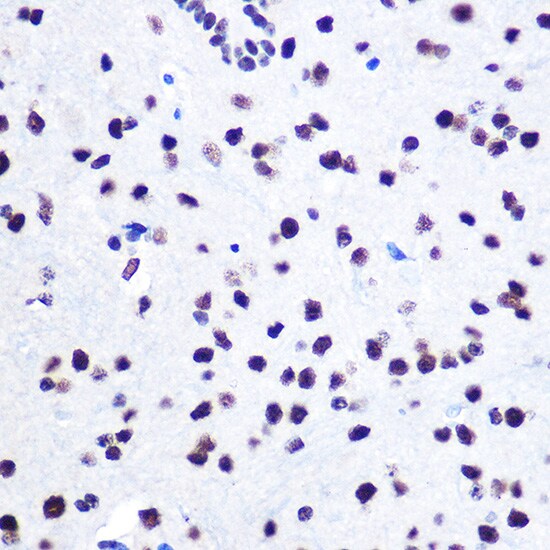 hnRNP C1 + C2 Antibody