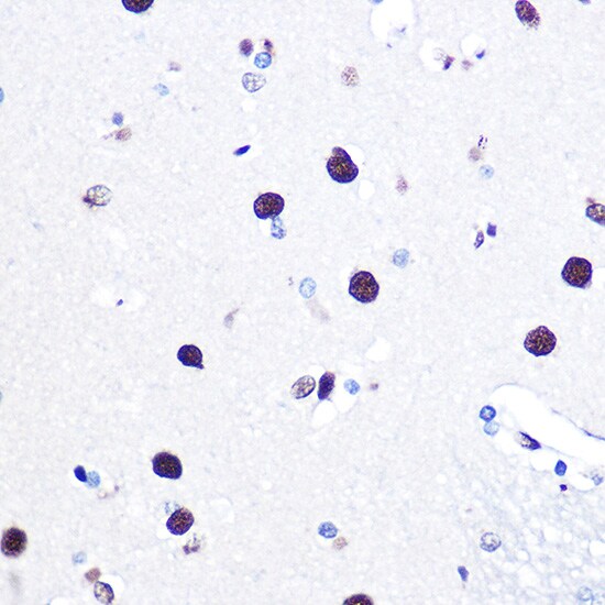 hnRNP C1 + C2 Antibody