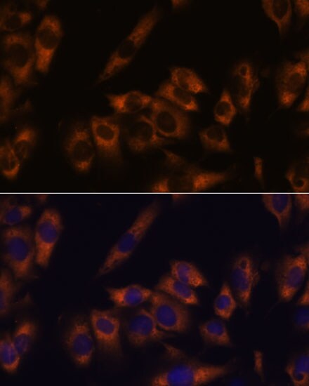 GRID2 Antibody