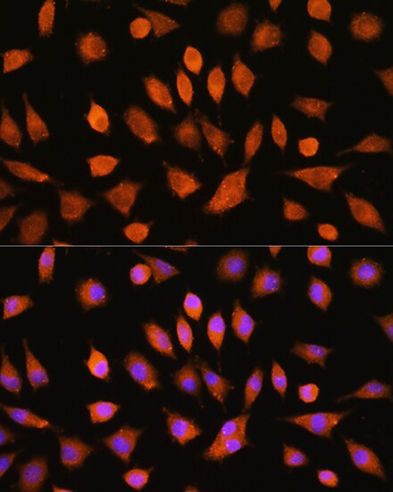 PIK4CA Antibody