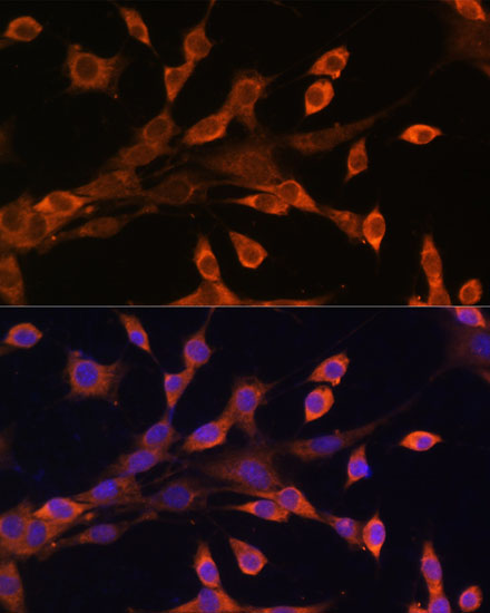 Protein Kinase A regulatory subunit I alpha Antibody