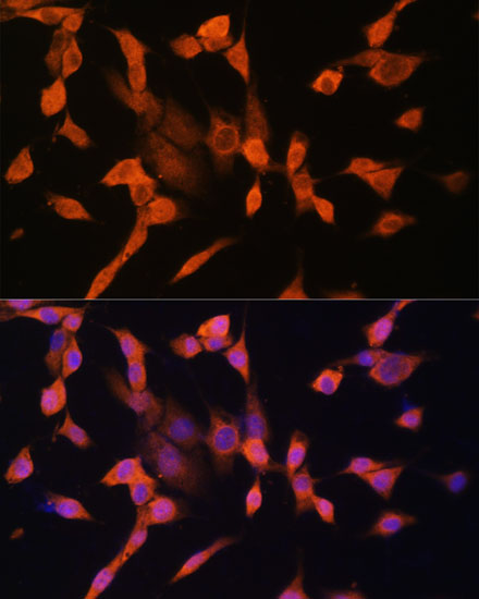 Protein Kinase A regulatory subunit I alpha Antibody