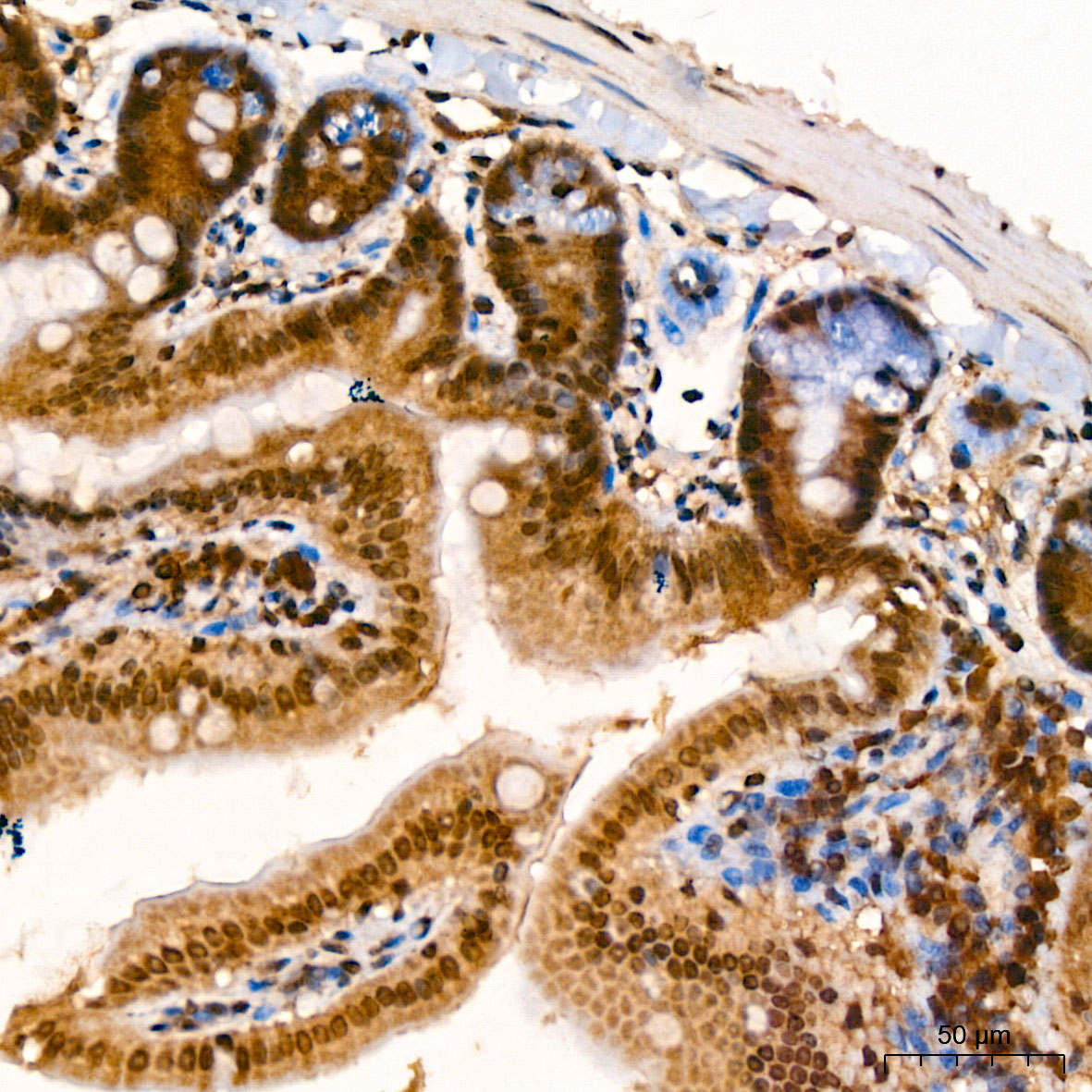PSMB5 Antibody
