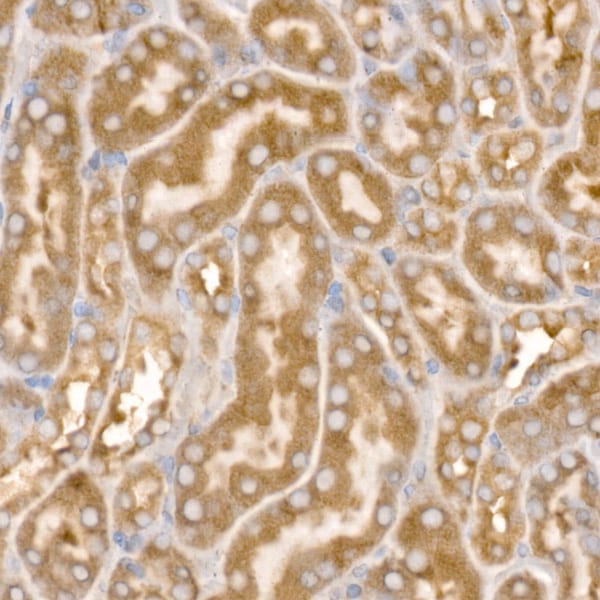 Beta 2 Adaptin Antibody