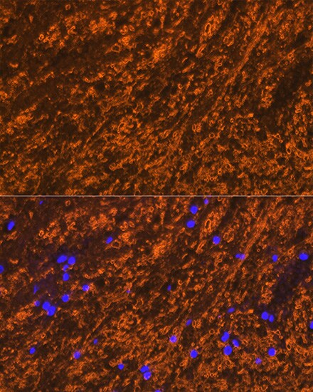 Myelin PLP Antibody
