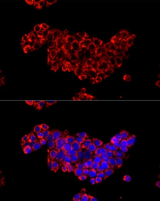 Citidine Deaminase Antibody